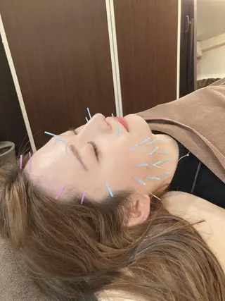 美容鍼サロンAcutyアキュティ吉祥寺所属・橋爪 弘樹のその他イメージ