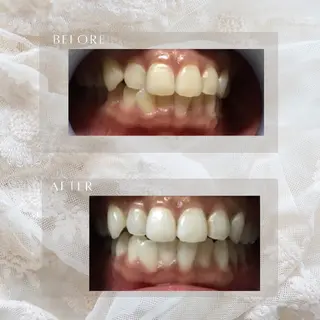 ホワイトニングサロン シロイハ所属・歯を白くしたい方🦷 シロイハのその他イメージ