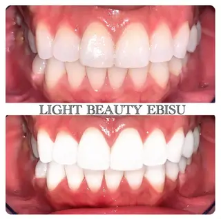 ライトビューティー 恵比寿店のその他イメージ