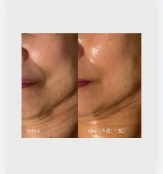 肌管理フェイシャル|Utouto所属・肌管理フェイシャル Utoutoのエステ・リラクイメージ