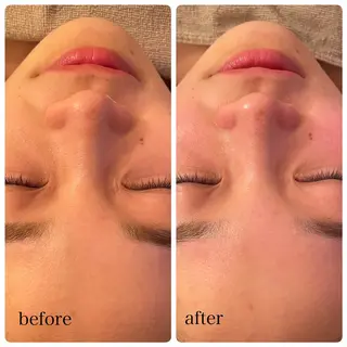 LONO  by a little所属・LONO byalittleのエステ・リラクイメージ