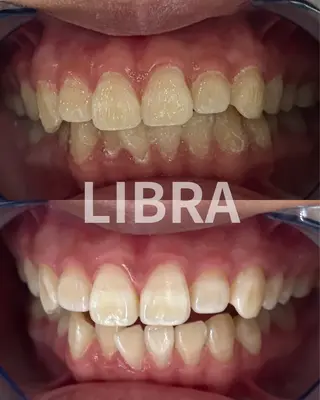 Libra所属・LIBRA心斎橋 セルフホワイトニングのその他イメージ