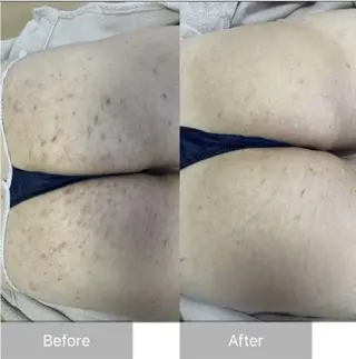 ハーブピーリング専門 COCO.梅田中津のエステ・リラクイメージ