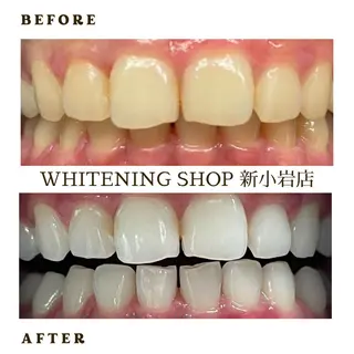 メンズ ホワイトニング ショップ新小岩店のその他イメージ