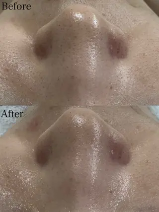 beautysalon LIMOA所属・松本 愛絵理のエステ・リラクイメージ