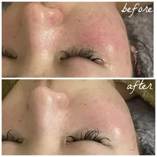 メンズ メナード岐阜茜部 杉浦のエステ・リラクイメージ