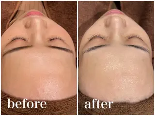 美肌脱毛専門店 ディオーネ四日市店のエステ・リラクイメージ