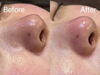 LingK/Este 駒田 辰玲のエステ・リラクイメージ