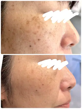 N.style所属・Ｎ. styleのネイルデザイン