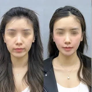 aliaハイフ&水光ジェットサロン所属・aliaハーブ水光店 エステティシャン募集のエステ・リラクイメージ