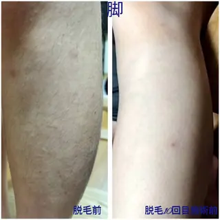 vi roots所属・vi rootsのエステ・リラクイメージ