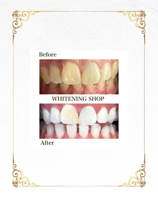 ホワイトニングショップ静岡葵区店所属・ホワイトニング ショップ葵区静岡駅店のその他イメージ