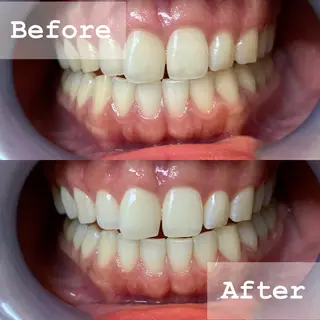 LBSホワイトニング 新宿店💝店長熊倉のエステ・リラクイメージ