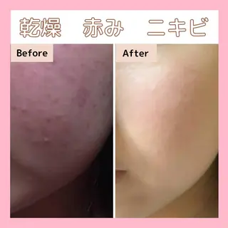 エステサロン　Sブランペタル所属・三沢市エステサロン Sブランペタルのエステ・リラクイメージ