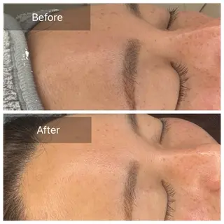 トータルしみケア専門 NICA(ニカ)のエステ・リラクイメージ