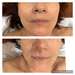 Silky ✖︎ Snow White｜エイジングケア＆美肌脱毛専門サロン所属・O 朋美のエステ・リラクイメージ