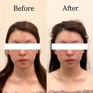 Hari Lounge恵比寿所属・chika🦋 ハリラウンジ恵比寿のエステ・リラクイメージ