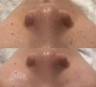 韓国系得意🦋 Aspire.のマツエク・マツパデザイン