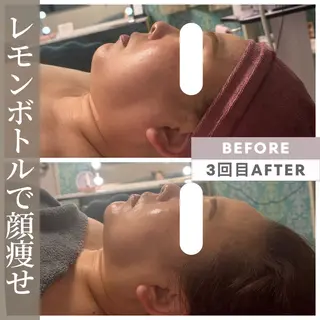 小顔矯正専門店 【RED】池田のエステ・リラクイメージ