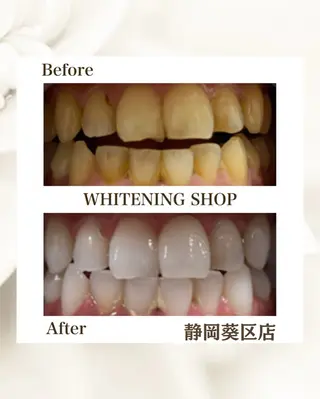 ホワイトニングショップ静岡葵区店所属・ホワイトニング ショップ葵区静岡駅店のその他イメージ