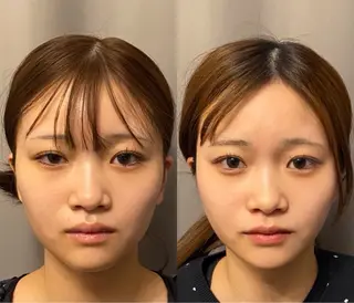 医療提携×美容整体 小顔ハイフピーリングのエステ・リラクイメージ