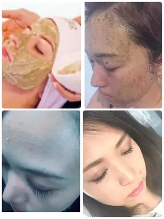 ダイエット／脱毛 美顔／フォト／ハーブのその他イメージ