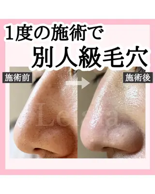 Salon Lelalaのエステ・リラクイメージ