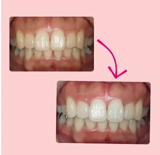 エクシアホワイトニング草津店所属・nanami -ホワイトニングのその他イメージ