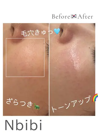 韓国🇰🇷価格 サロン_Nbibiのエステ・リラクイメージ