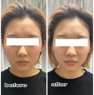 ENCHANT 脱毛.小顔.毛穴のエステ・リラクイメージ