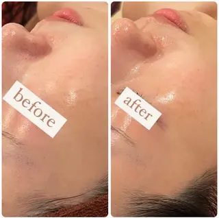 立体小顔×艶肌×美ボ ディ似合わせ施術 岡のエステ・リラクイメージ