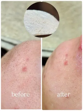 sourire.11 ‪☺︎‬‪emiのエステ・リラクイメージ