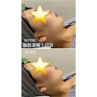 毛穴洗浄・痩身・脱毛 /アルカンジュのエステ・リラクイメージ