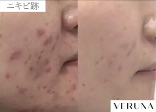 業界初の頭皮ケア 棘スカルプLUNEAのヘアスタイル