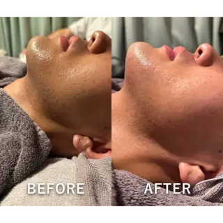 メンズ Aurora所属・目元美×脱毛 Clé-yunaのエステ・リラクイメージ