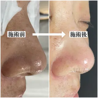 MUKU所属・毛穴専門サロン MUKUムクのエステ・リラクイメージ