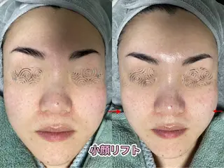 ホワイティアビシェル ウラワ　白澤奇のエステ・リラクイメージ