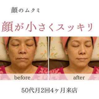 オアシス・さくら所属・自然美人を叶える小顔 と脱毛サロンのエステ・リラクイメージ