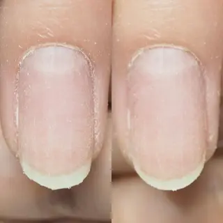 ネイル ネイルアーティスト アリスのネイルデザイン