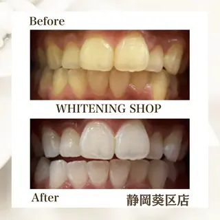 ホワイトニングショップ静岡葵区店所属・ホワイトニング ショップ葵区静岡駅店のその他イメージ