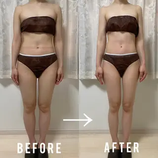 BeauL銀座 村浜友菜🤍のエステ・リラクイメージ