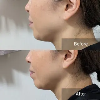 nail RiRi アトレナチュラのエステ・リラクイメージ