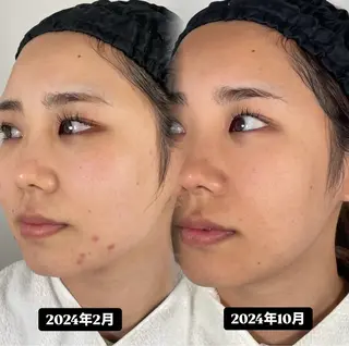 🫧美しい素肌へ🫧 今成柚乃のその他イメージ