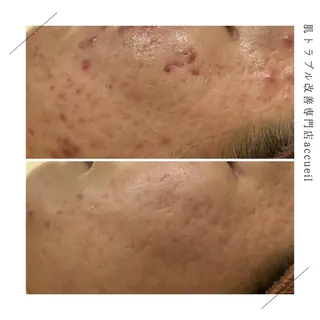 ロング カラー パーマ ヘアアレンジ メンズ キッズ ネイル マツエク・マツパ アイブロウ 触れたくなる モテ肌へ...❤︎のエステ・リラクイメージ