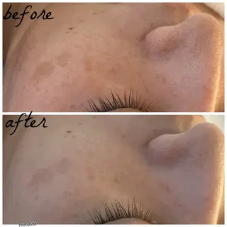 メンズ メナード岐阜市茜部 杉浦のエステ・リラクイメージ