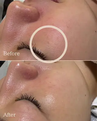 エステと焼き菓子 レモンバームソワンのエステ・リラクイメージ