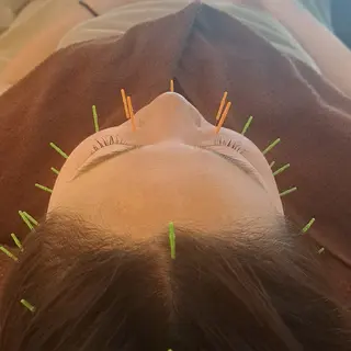 鍼灸サロンmiyabi所属・美容鍼×エステ　鍼灸 サロンmiyabiのエステ・リラクイメージ