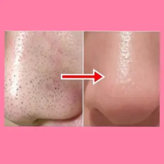 肌ケア＆毛穴洗浄 Cheriのエステ・リラクイメージ