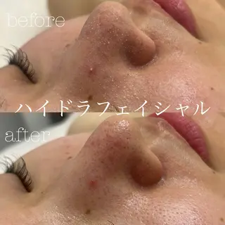 フェイシャルサロン CHIARA 荒田のエステ・リラクイメージ