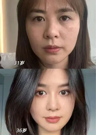 ネイル aliaハイフ&水光ジェットサロン所属・aliaハーブ水光店 エステティシャン募集のエステ・リラクイメージ